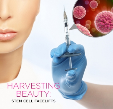 Harvesting Beauty: Stem Cell Facelifts