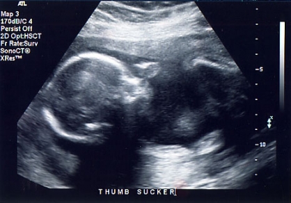 ultrasound_1242594500.jpg