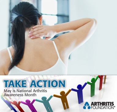 Arthritis: The leading cause of disability in the US