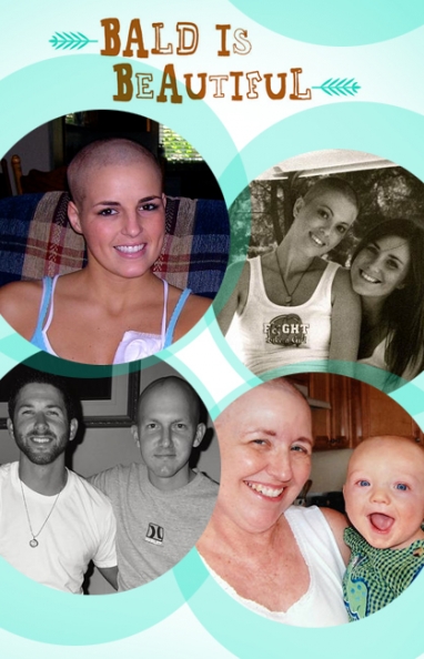 Bald Is Beautiful: Offering Special Gifts to Cancer Patients