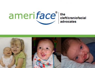 AmeriFace: Changing the face of cleft-related nonprofits