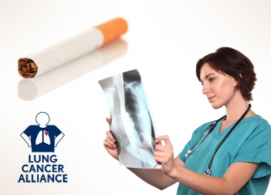 The largely ignored face of lung cancer